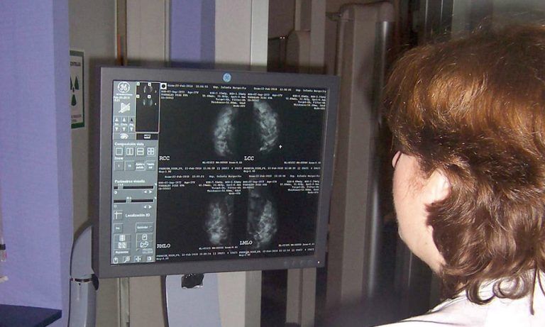 El Programa para la Detección Precoz de Cáncer de Mama cubre a más de 1,2 millones de andaluzas