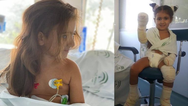 La lucha para salvar las extremidades de la niña Carlota, de cuatro años, tras sufrir una septicemia