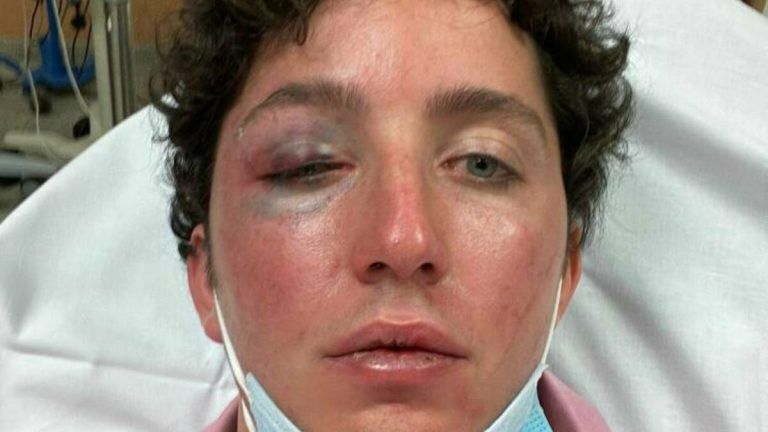 El ‘pequeño Nicolás’ denuncia haber sido agredido a la salida del Starlite en Marbella