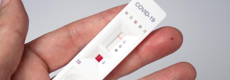 El Gobierno fija en 2,94 euros el precio máximo de los test de antígenos de venta en farmacias