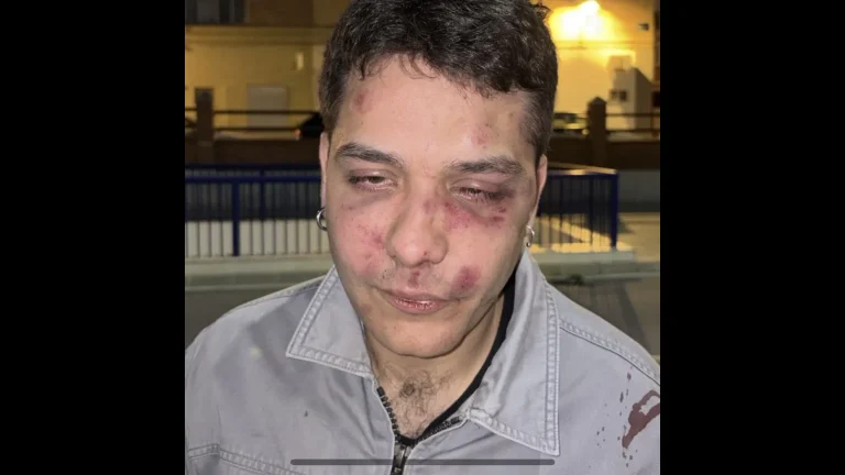 Un joven denuncia una paliza tras salir de una discoteca de Málaga